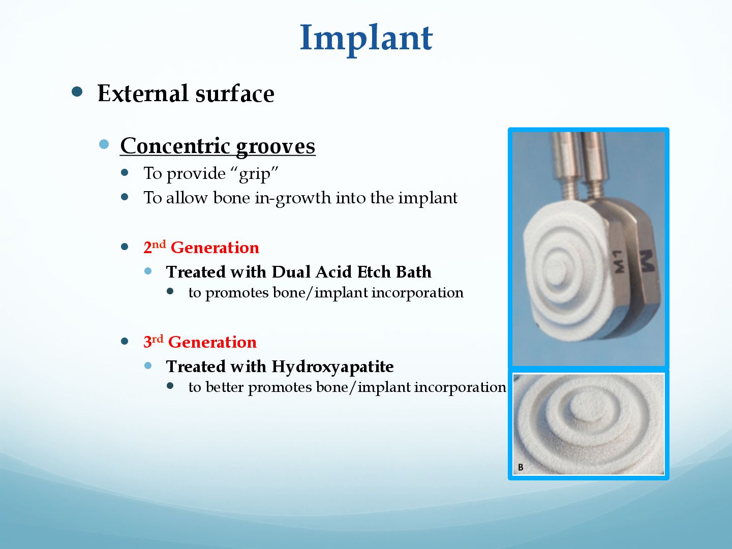 681f2b96166356c33097fdd1c2ffe304-115